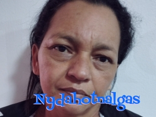 Nydahotnalgas